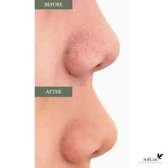 Dr.Althea Anastatica Skin Conditioning Pad