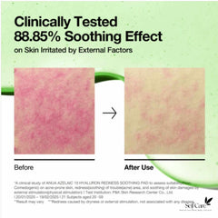 ANUA - AZELAICACID 10 HYALURON SOOTHING PAD - 230ml (90E