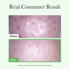 Arencia Pore Melt Mochi Cleansing oil