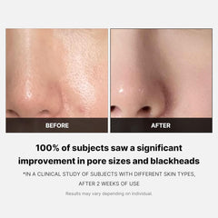 Medicube Zero Pore Pad 2.0 155g