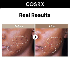 COSRX - The Alpha-Arbutin 2 Discoloration Care Serum - 50ml